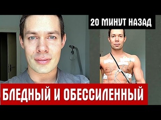 РАЗДАВЛЕННЫЙ Стас Пьеха предстал весь в дырках от коронарографии и излил душу фанатам