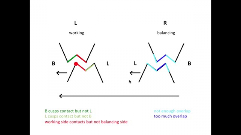 Selective Equilibration of Denture Teeth.